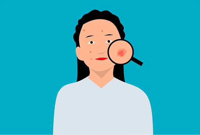 Si vous remarquez l'un de ces signes chez un grain de beauté, il est important de consulter un dermatologue dès que poss