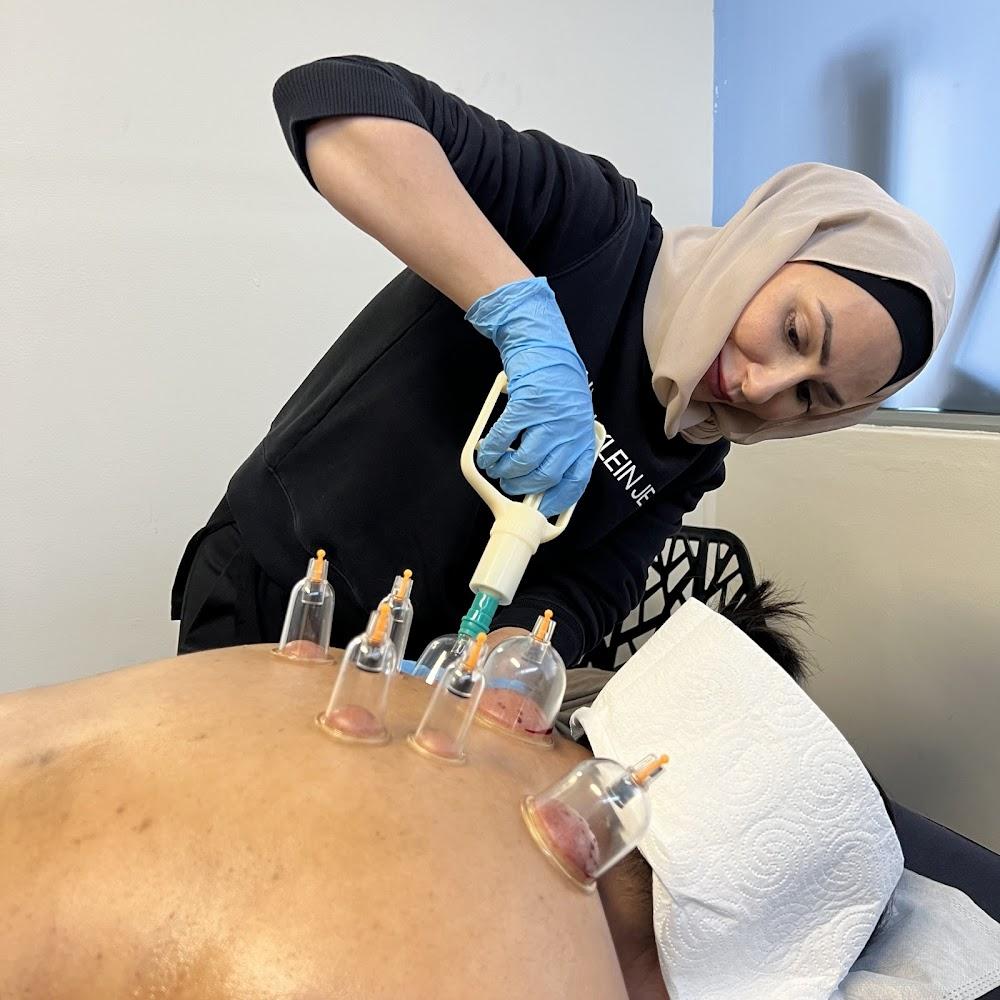 la Hijama - cupping thérapy