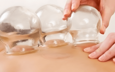 Formation ventouses et Moxibustion au Pradet près de Toulon