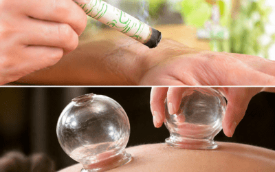 Formation ventouses et Moxibustion au Pradet près de Toulon