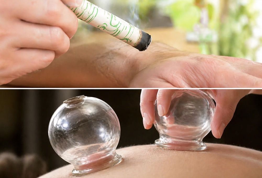 Formation ventouses et Moxibustion au Pradet près de Toulon