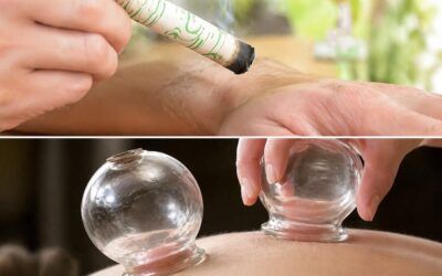 Formation ventouses et Moxibustion au Pradet près de Toulon