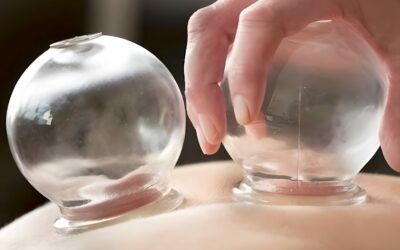 Formation ventouses et Moxibustion au Pradet près de Toulon